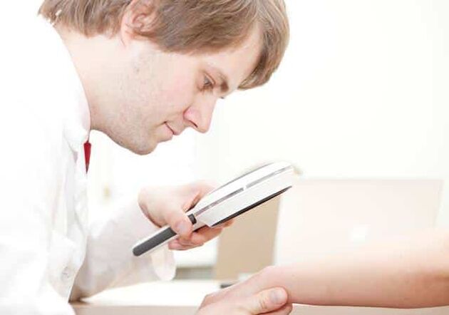 Diagnoza psoriaze pri dermatologu